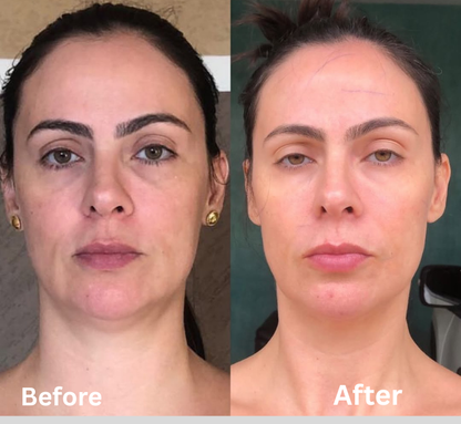 Refined Definition . Without Clinics, Without Effort